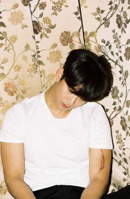 옥택연 팔에 큰 흉터가 생긴 이유.jpg | 인스티즈