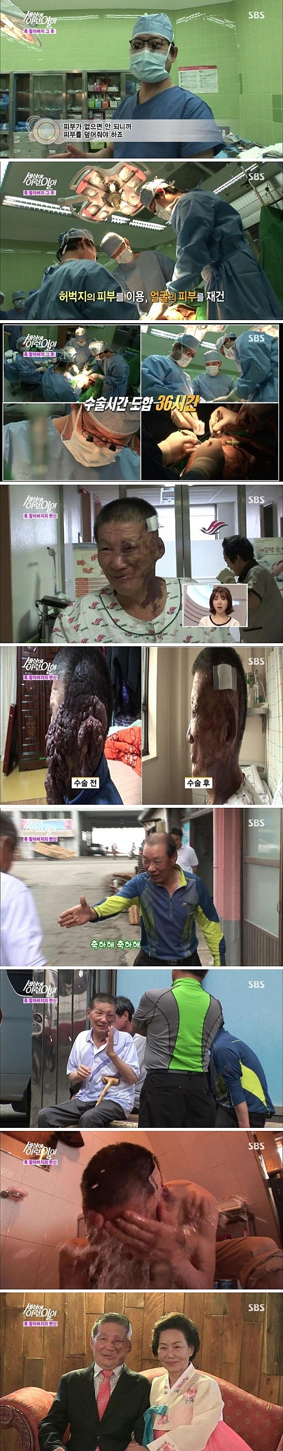 성형수술 레전드.jpg | 인스티즈
