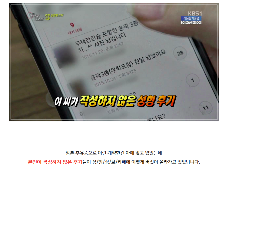 성형 과장광고 & 전후사진 모두 보정가짜 속지맙시다.jpg | 인스티즈