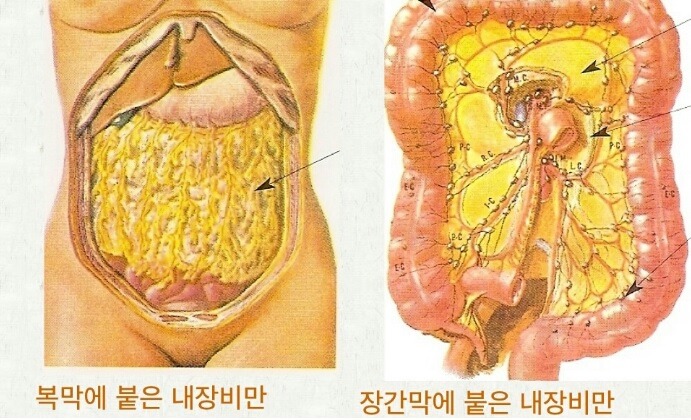 침묵의 암살자 뱃속의 시한폭탄 내장지방의 위험성 | 인스티즈