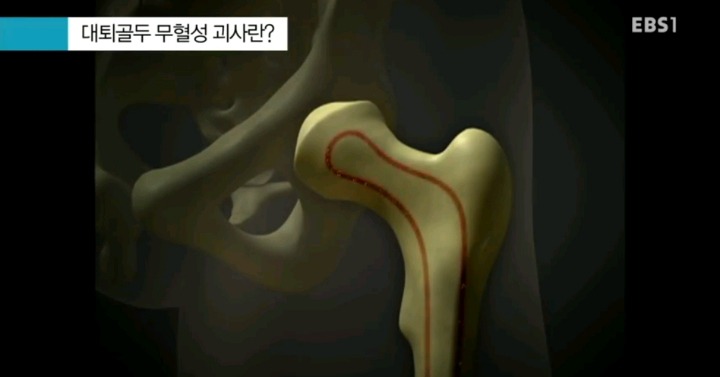 무서운 스테로이드 부작용.jpg | 인스티즈