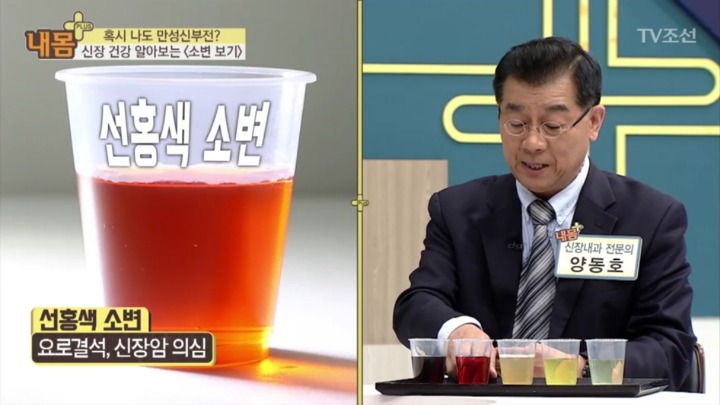 소변 색으로 보는 신장 건강 | 인스티즈