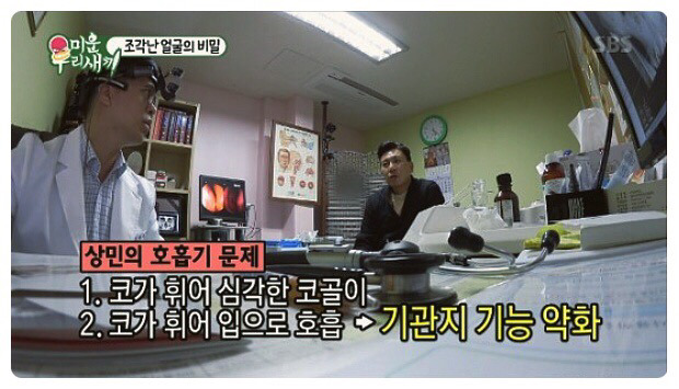 이상민 얼굴에 박혀있는 수많은 나사 | 인스티즈