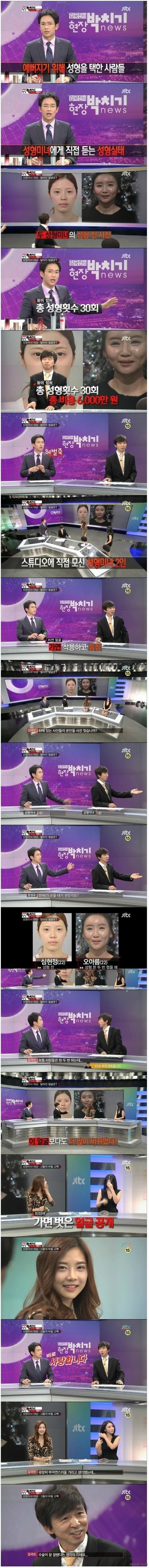 성형수술 30번 한 여자의 모습 | 인스티즈
