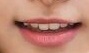 입술을 보고 어느 연예인인지 맞추기 | 인스티즈