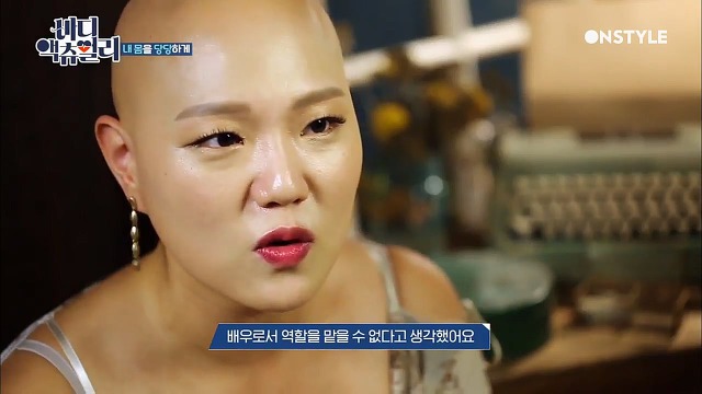 전신탈모증 윤사비나씨가 생각하는 아름다움.jpg | 인스티즈